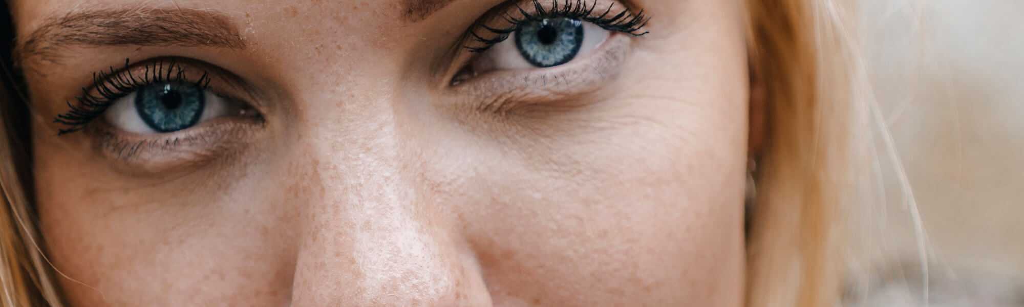 5 Ways To Beat A Dull Complexion New