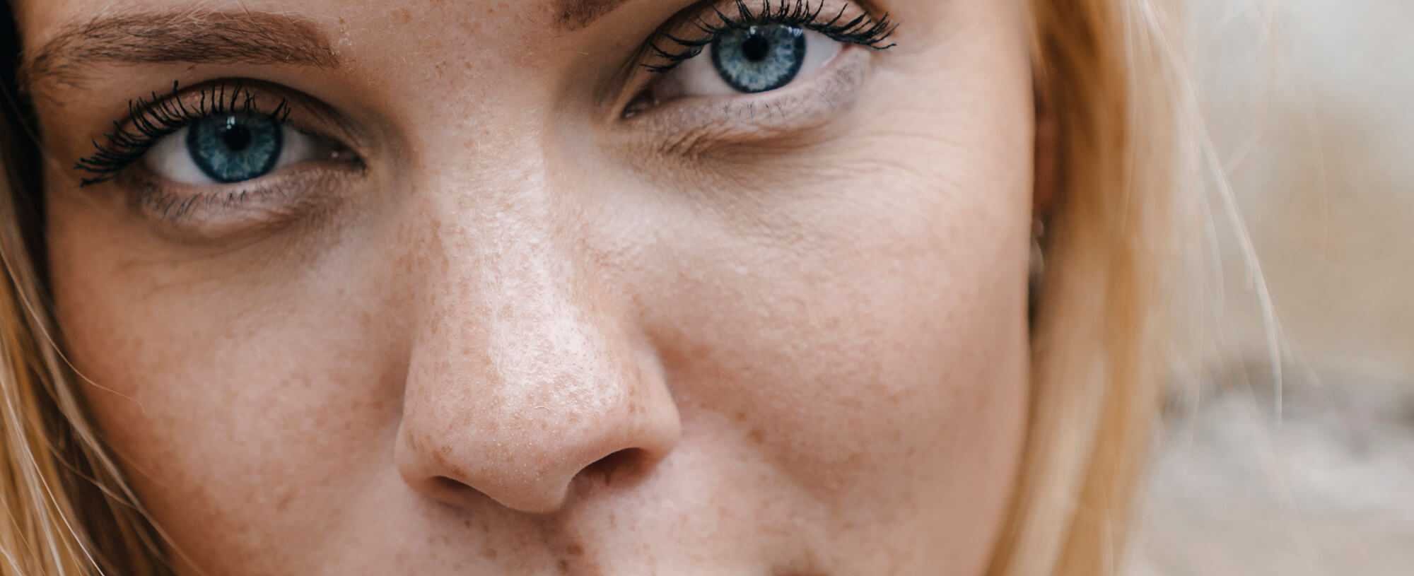 5 Ways To Beat A Dull Complexion New