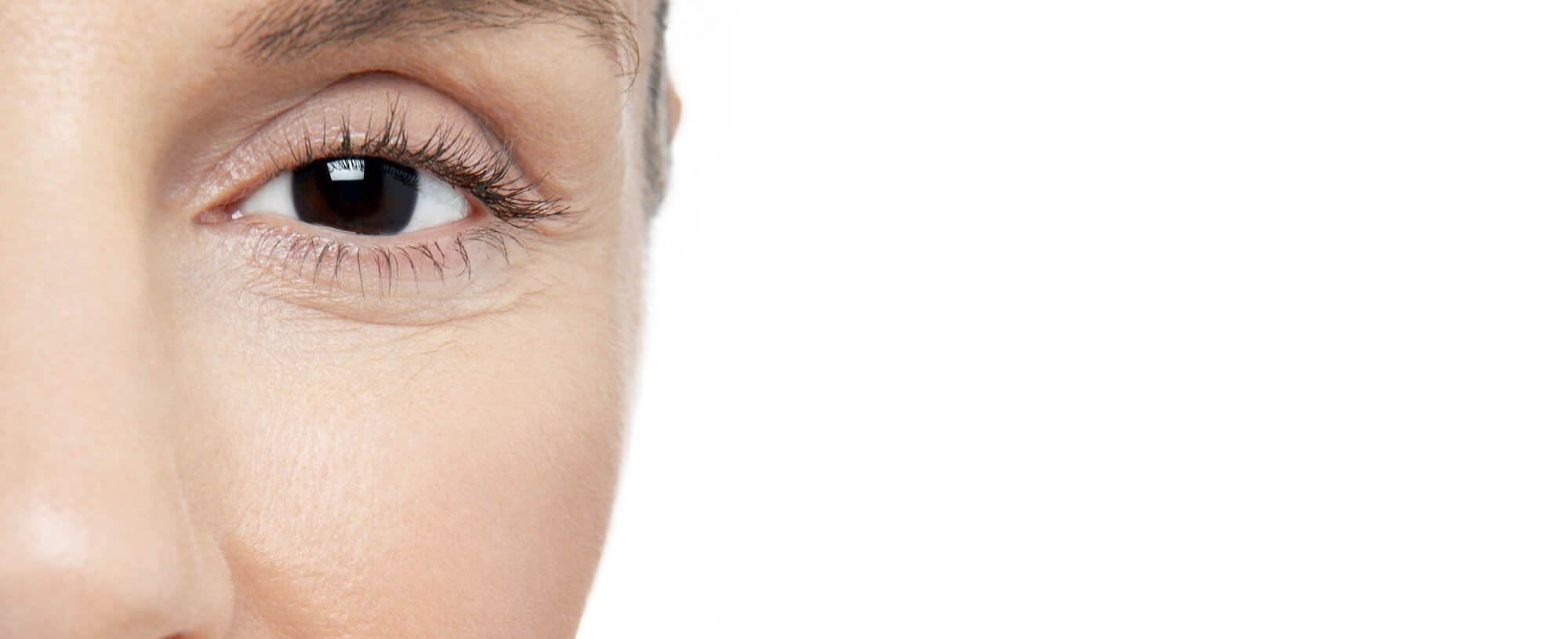 Atopic Skin True Vs False Hero