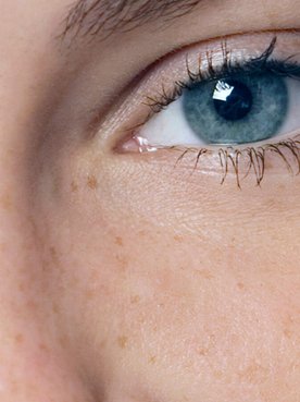 Glycolic Acid And Retinol