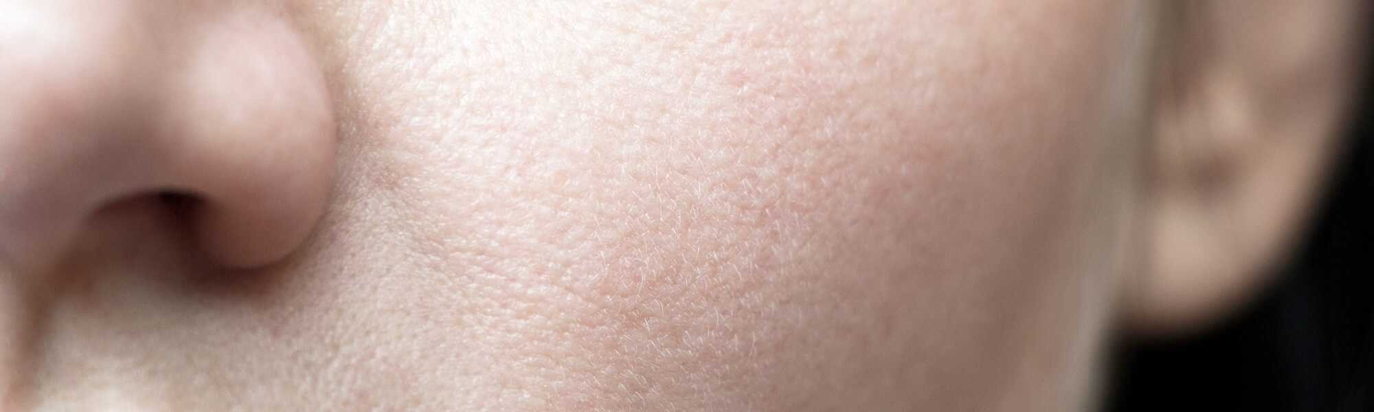 Homemade Tips To Get Rid Of Dry Skin