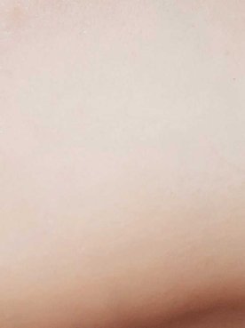How To Calm Flushed Skin After A Work Out