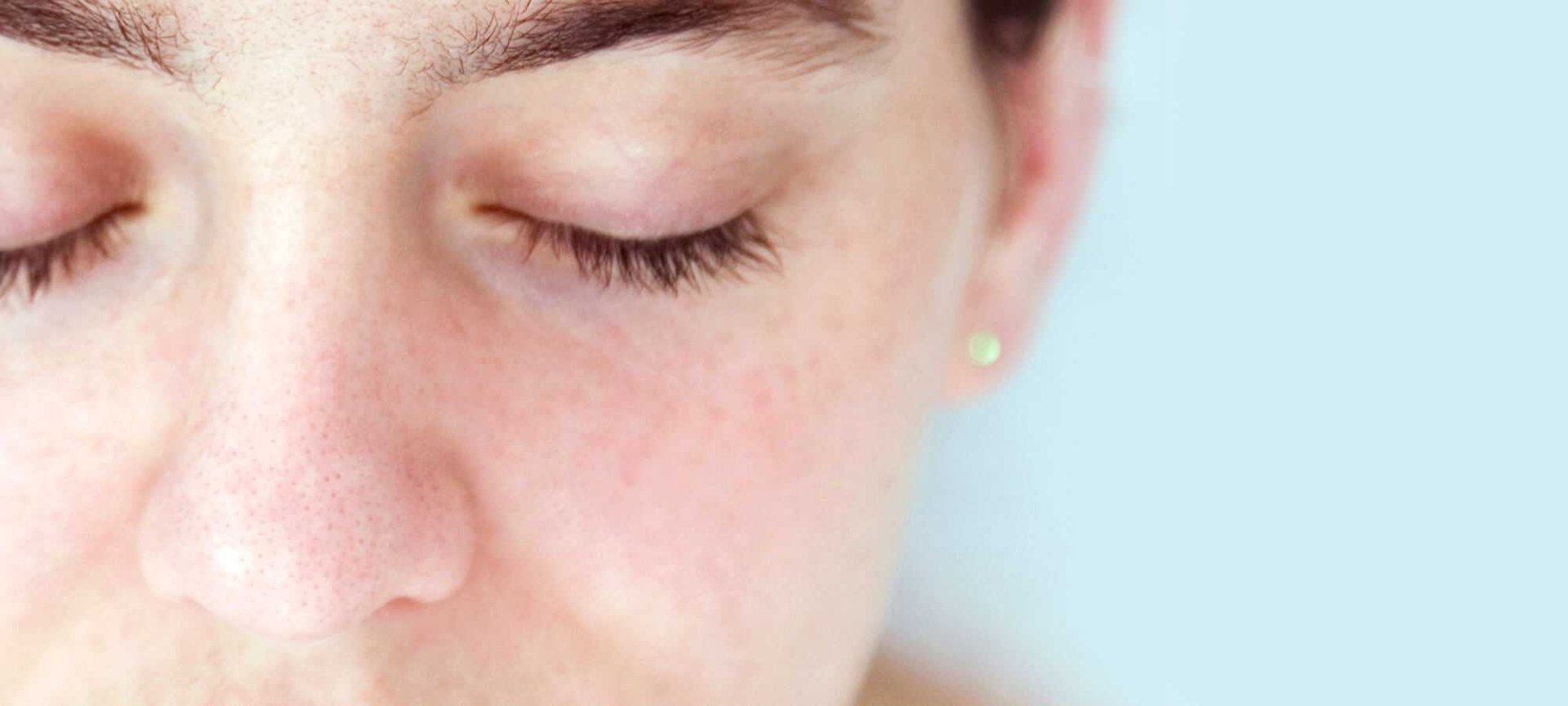 Hypoallergenic A Magic Word For Sensitive Skin