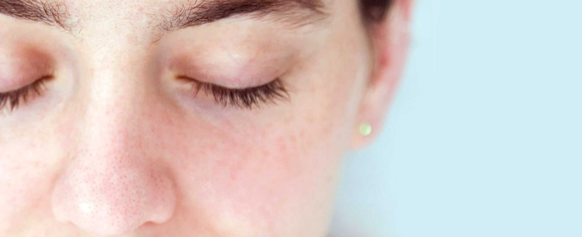 Hypoallergenic A Magic Word For Sensitive Skin