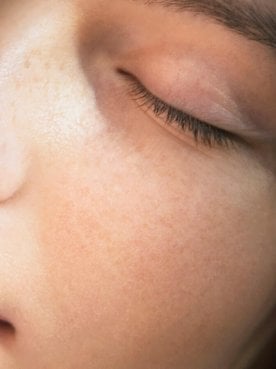 Kiss Dark Circles Goodbye For Once And For All