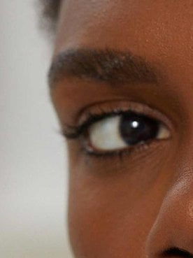Causes of Under-Eye Bags