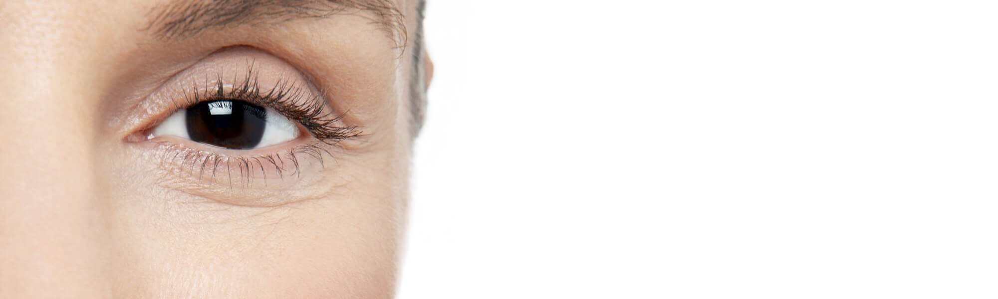 Puffy Panda Eyes Check Out These Four Complementary Therapies Hero