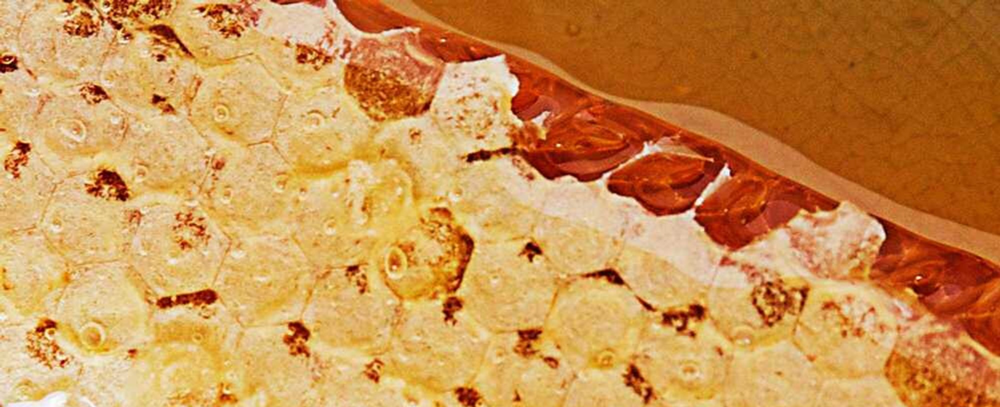 Royal Jelly The Hard Facts About Our Wintertime Bff