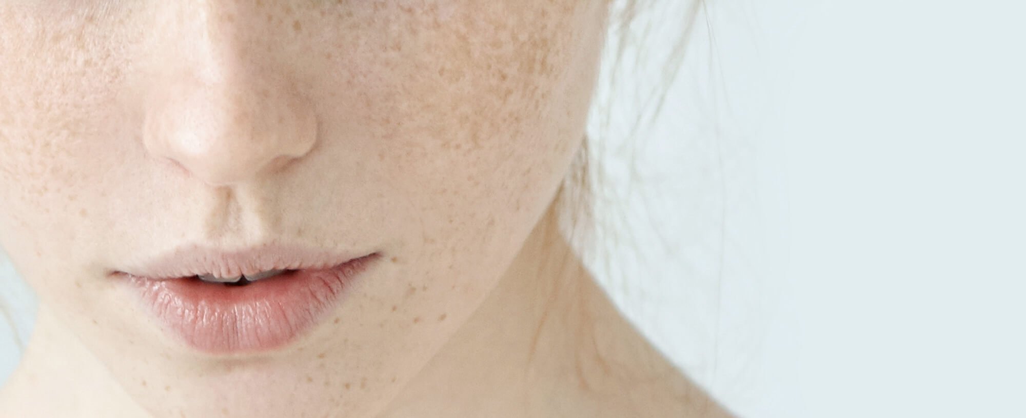Say No To Skin Imperfections Article