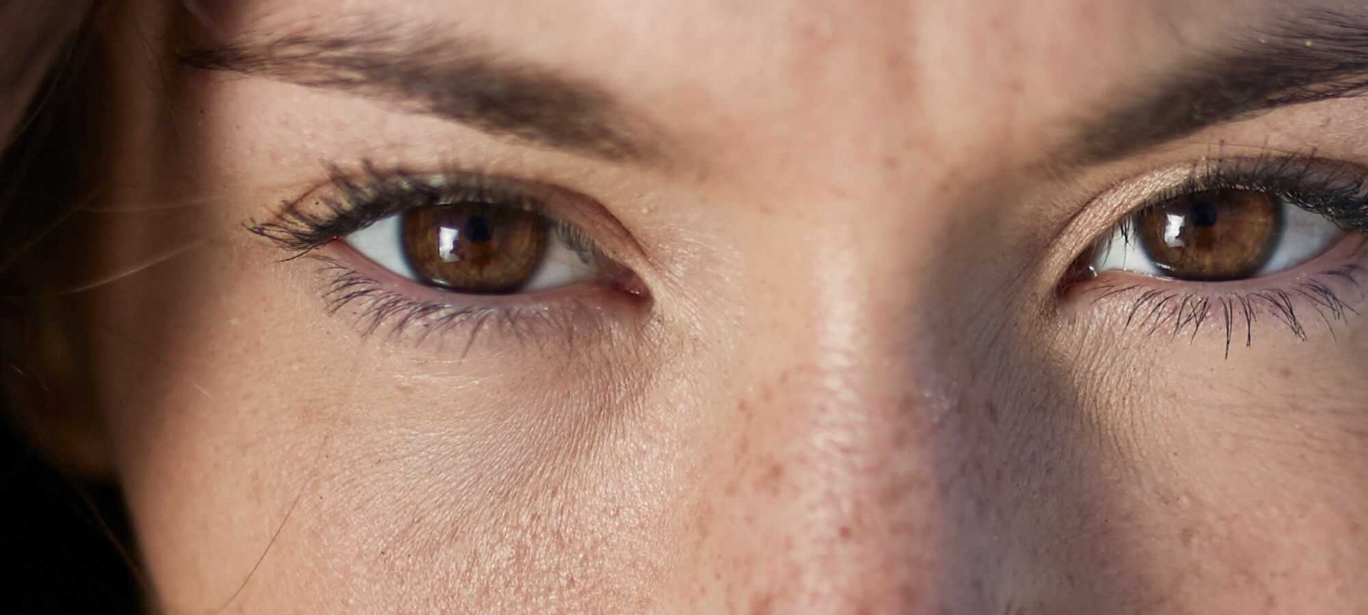 The Best Natural Remedies For Puffy Eyes