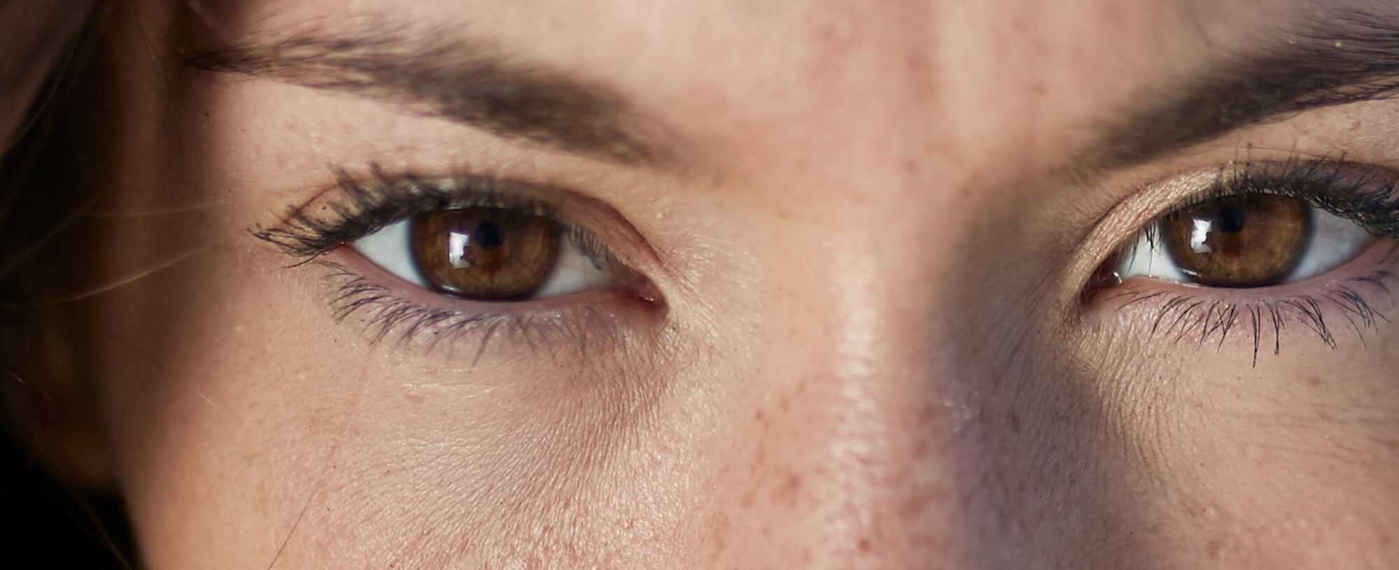 The Best Natural Remedies For Puffy Eyes
