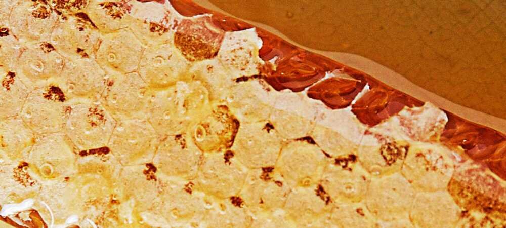 Why Royal Jelly Delivers Skin Fit For A Queen