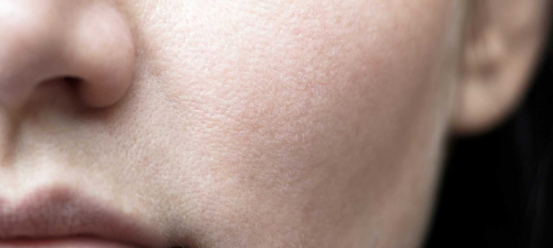 Zap Open Pores Top 10 Glowing Skincare Tips