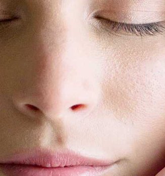 How to remove blackheads on Nose