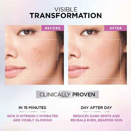 Dark Spots & Uneven Skin Tone - Glycolic Acid