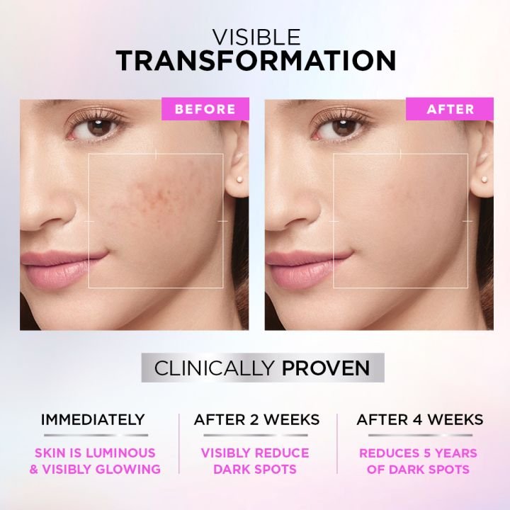 L'Oreal Paris Glycolic Acid Skin Brightening Serum for Dark Spots