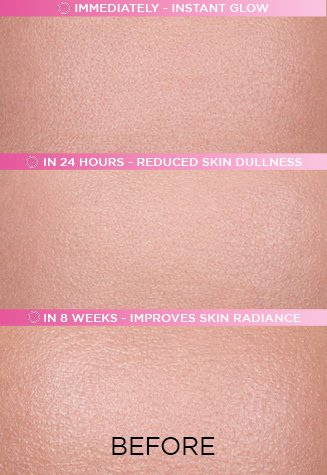1 Before Matte Lumi APP