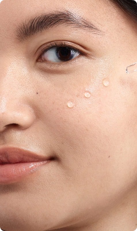 Skin Type 1