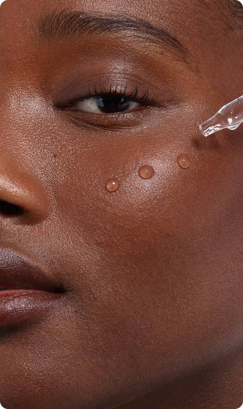 Skin Type 2